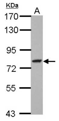 Western Blot: GFPT2 Antibody [NBP2-16649]