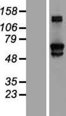 Western Blot: GFPT2 Overexpression Lysate [NBL1-11050]