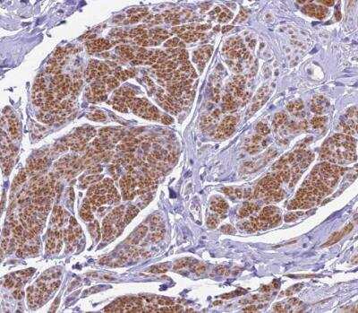 Immunohistochemistry-Paraffin: GFR alpha-1/GDNF R alpha-1 Antibody [NBP2-14045]