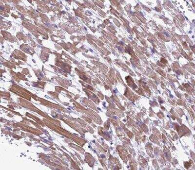 Immunohistochemistry-Paraffin: GFR alpha-1/GDNF R alpha-1 Antibody [NBP2-14045]