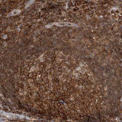 Immunohistochemistry-Paraffin: GFR alpha-2/GDNF R alpha-2 Antibody [NBP1-89778]
