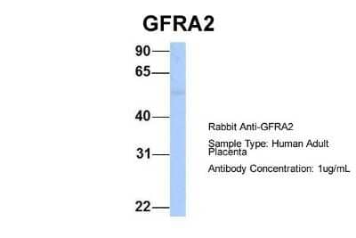 Western Blot: GFR alpha-2/GDNF R alpha-2 Antibody [NBP1-79553]