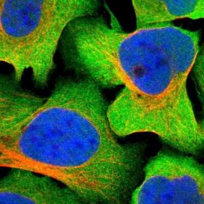 Immunocytochemistry/ Immunofluorescence: GFR alpha-3/GDNF R alpha-3 Antibody [NBP1-89774]