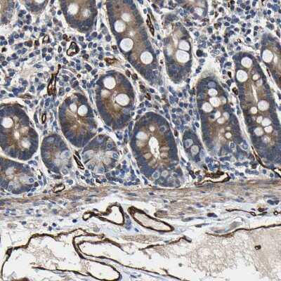 Immunohistochemistry-Paraffin: GFR alpha-3/GDNF R alpha-3 Antibody [NBP1-89774]