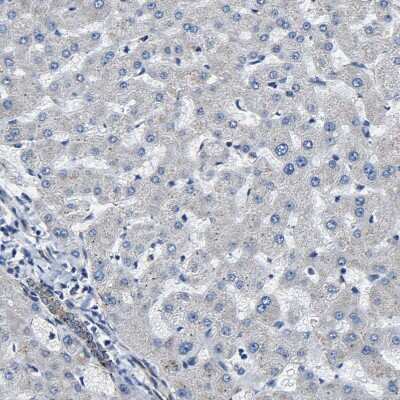 Immunohistochemistry-Paraffin: GFR alpha-3/GDNF R alpha-3 Antibody [NBP1-89774]