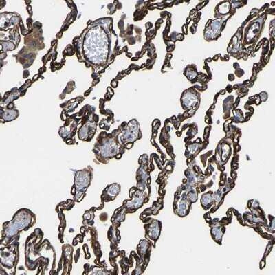 Immunohistochemistry-Paraffin: GFR alpha-3/GDNF R alpha-3 Antibody [NBP1-89774]