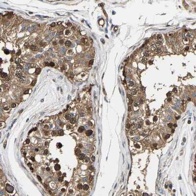 Immunohistochemistry-Paraffin: GFR alpha-3/GDNF R alpha-3 Antibody [NBP1-89774]