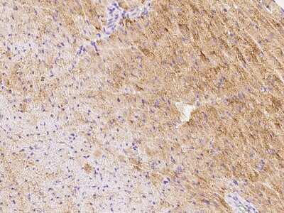 Immunohistochemistry-Paraffin: GFR alpha-3/GDNF R alpha-3 Antibody [NBP2-99437]