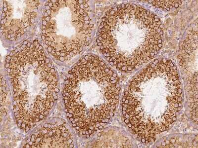 Immunohistochemistry-Paraffin: GFR alpha-3/GDNF R alpha-3 Antibody [NBP2-99437]