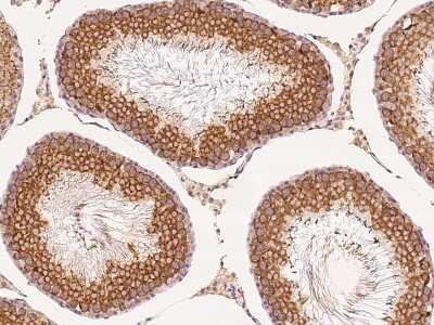 Immunohistochemistry-Paraffin: GFR alpha-3/GDNF R alpha-3 Antibody [NBP2-99437]