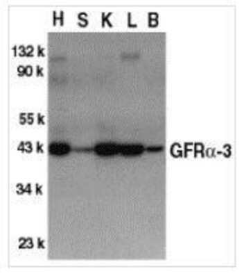 Western Blot: GFR alpha-3/GDNF R alpha-3 AntibodyBSA Free [NBP1-77035]