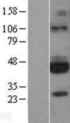 Western Blot: GFR alpha-3/GDNF R alpha-3 Overexpression Lysate [NBL1-11053]