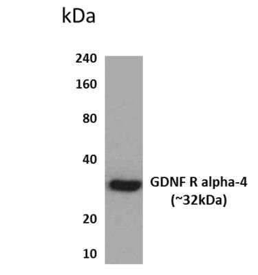 Western Blot: GFR alpha-4/GDNF R alpha-4/Persephin receptor Antibody (MM0311-3P34)Azide and BSA Free [NBP2-12414]