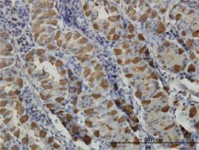 Immunohistochemistry-Paraffin: GGA1 Antibody (3F11) [H00026088-M01]