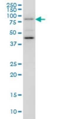 Western Blot: GGA1 Antibody (3F11) [H00026088-M01]