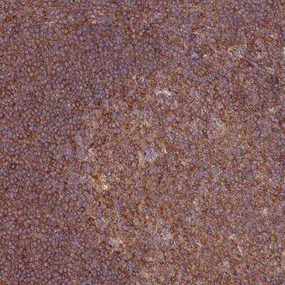 Immunohistochemistry-Paraffin: GGA1 Antibody [NBP2-14048]
