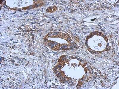 Immunohistochemistry-Paraffin: GGA1 Antibody [NBP2-16650]