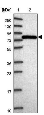 Western Blot: GGA1 Antibody [NBP2-14047]