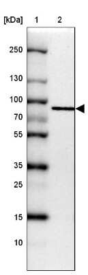 Western Blot: GGA1 Antibody [NBP2-14048]