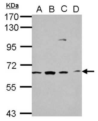 Western Blot: GGA1 Antibody [NBP2-16650]