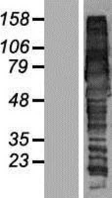 Western Blot: GGA1 Overexpression Lysate [NBP2-08986]