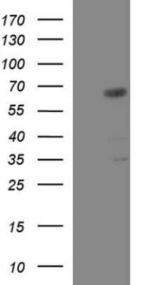 Western Blot: GGA2 Antibody (OTI1D2) [NBP2-45853]