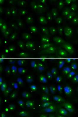 Immunocytochemistry/ Immunofluorescence: GGA2 Antibody - BSA Free [NBP3-04640]