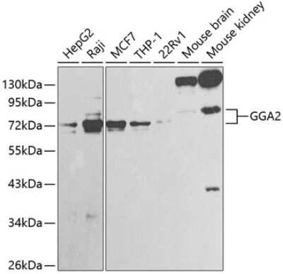 Immunohistochemistry-Paraffin: GGA2 Antibody - BSA Free [NBP3-04640]