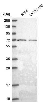 Western Blot: GGA2 Antibody [NBP2-58645]