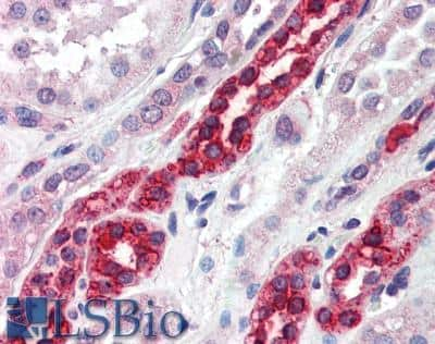 Immunohistochemistry-Paraffin: GGA3 Antibody [NB100-2444]