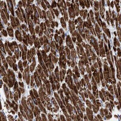 Immunohistochemistry-Paraffin: GGA3 Antibody [NBP1-83033]