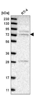 Western Blot: GGA3 Antibody [NBP2-55191]