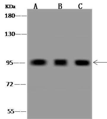 Western Blot: GGA3 Antibody [NBP3-05941]