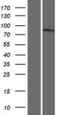 Western Blot: GGA3 Overexpression Lysate [NBP2-05616]