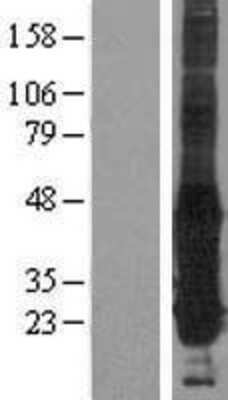 Western Blot: gamma-Glutamylcyclotransferase/CRF21/GGCT Overexpression Lysate [NBP2-06360]