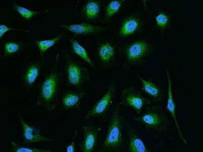 Immunocytochemistry/ Immunofluorescence: GGCX Antibody [NBP2-98509]