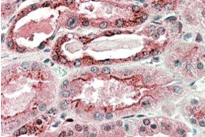Immunohistochemistry-Paraffin: GGCX Antibody [NBP1-51964]