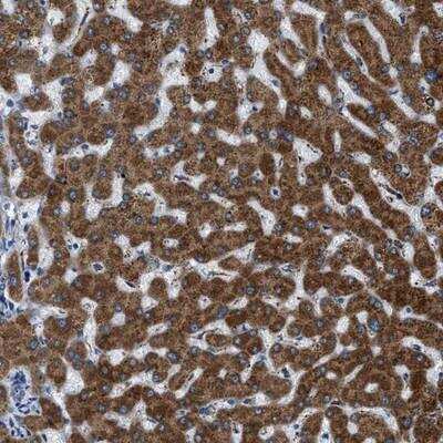 Immunohistochemistry-Paraffin: GGCX Antibody [NBP1-80624]