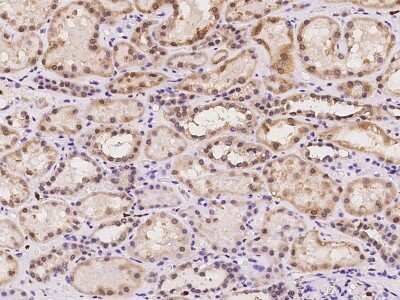 Immunohistochemistry-Paraffin: GGCX Antibody [NBP2-98509]