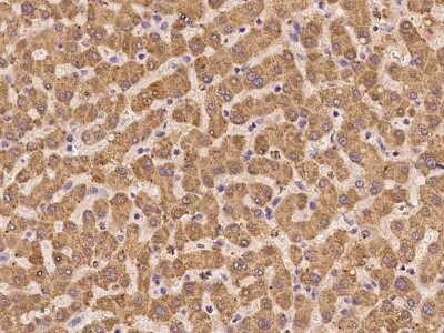 Immunohistochemistry-Paraffin: GGCX Antibody [NBP2-98509]