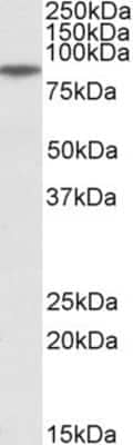 Western Blot: GGCX Antibody [NBP1-51964]