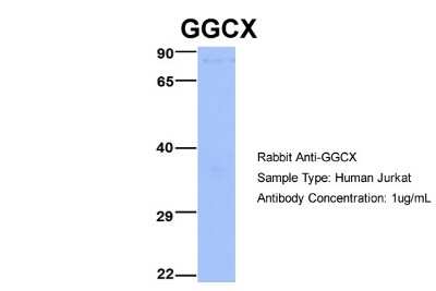 Western Blot: GGCX Antibody [NBP1-59394]