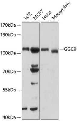 Western Blot: GGCX AntibodyBSA Free [NBP3-05062]