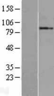 Western Blot: GGCX Overexpression Lysate [NBL1-11056]