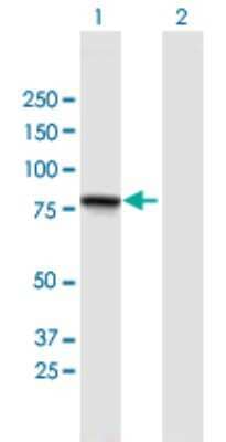 Western Blot: GGN Antibody [H00199720-B01P]