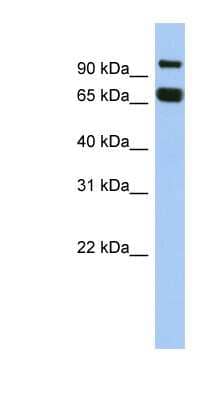 Western Blot: GGN Antibody [NBP1-53063]