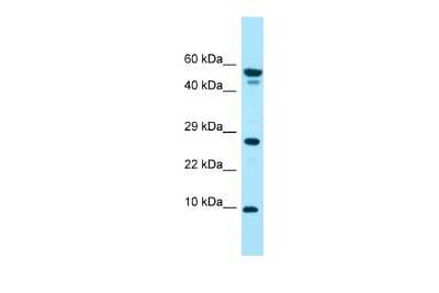 Western Blot: GGNBP1 Antibody [NBP3-09491]