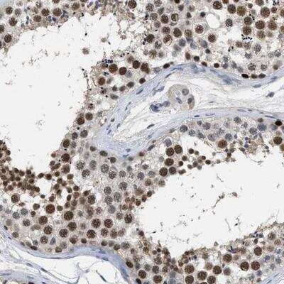 Immunohistochemistry-Paraffin: GGNBP2 Antibody [NBP1-90585]