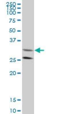 Western Blot: GGPS1 Antibody (1C3) [H00009453-M08]