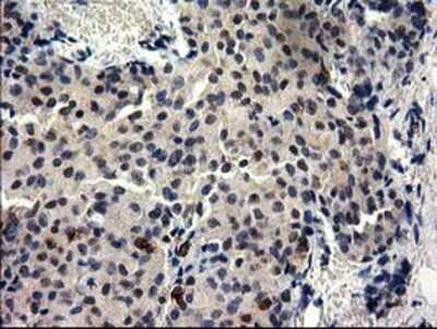 Immunohistochemistry-Paraffin: GGPS1 Antibody (OTI3F9) [NBP2-03037]